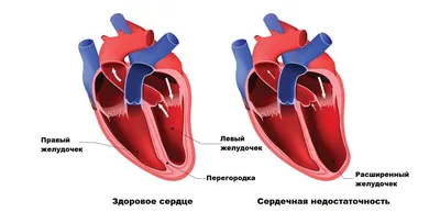 Белорусские учёные разработали биологический клапан сердца! В чём его  преимущества?