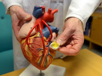 Можно ли создать идеальный клапан сердца, или что не так с биопротезами |  Пикабу