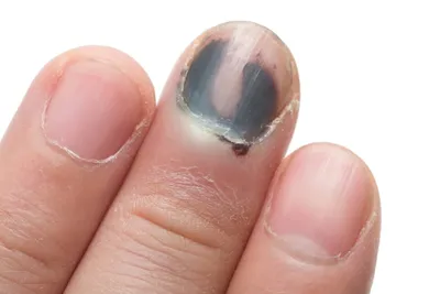 Покрытие ногтей гель-лаком в салоне - «Гель-лак с 12 лет, длинные ногти без  наращивания | Несмотря на лечение длиною в 9 месяцев, все равно не  отказалась от покрытия | 50 нэил мастеров,