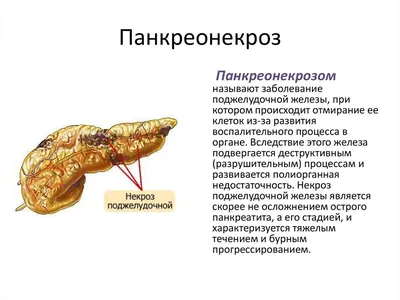 Панкреатит симптомы и лечение у взрослых в Москве в ФНКЦ ФМБА России