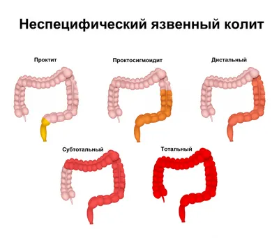 Желтуха: виды, причины, лабораторная диагностика синдрома желтухи | Клиника  Эксперт