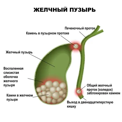 Диагностика целиакии (Антитела к тканевой трансглутаминазе IgG,IgA) |  ВИРА-Центр г. Нефтеюганск