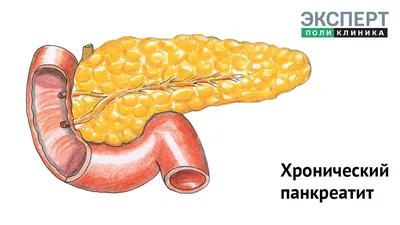 ⚕ Панкреатит: симптомы, причины, лечение ➡ Киев