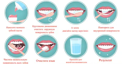 Что такое зубной камень? - блог «ДИНАСТИЯ»