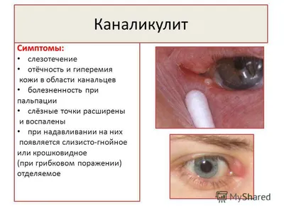 Что делать, если у собаки слезятся глаза?