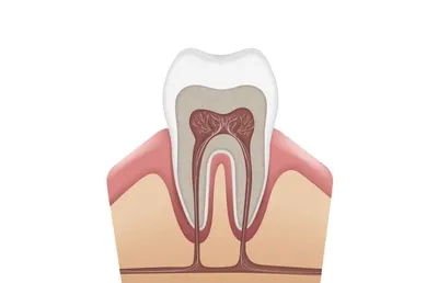 Зачем нужна чистка каналов зуба?