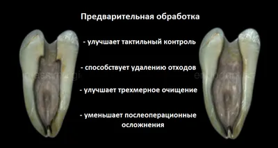Лечение каналов зуба [методы и цены лечения в Москве]
