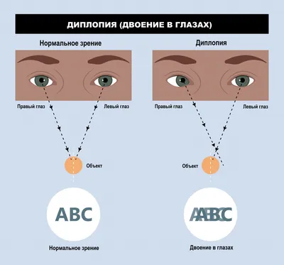 Что может быть? Помогите советом | Пикабу