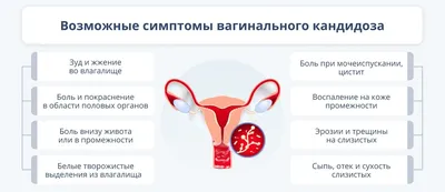 Кандидоз симптомы и лечение у женщин и мужчин: Клинические рекомендации