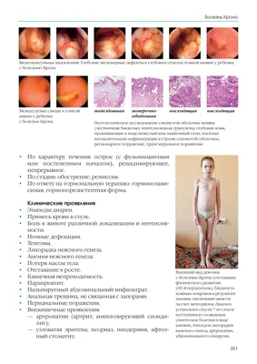 Experience of successful use of intense pulsed light in the treatment of  Shamberg patients - Arkatova - Russian Journal of Skin and Venereal Diseases