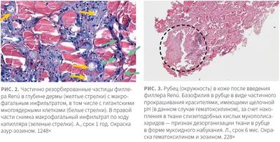 На данной фотографии изображено лечение \"кожного васкулита в эрозивной  форме\" Превосходный результат за 1.5 месяца!!! Записаться вы можете в любой  день... | By Клиника Лазмед центр лазерных технологий | Facebook