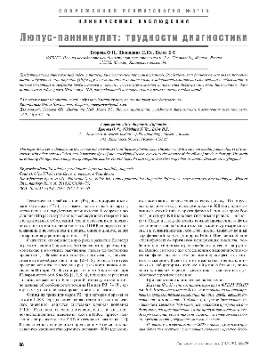 Case history of mixed connective tissue disease - Verkhotin - Journal of  Clinical Practice