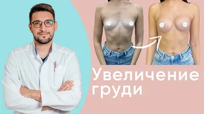 🔻ДОКТОР, ЧТО ТАКОЕ КАПСУЛЯРНАЯ КОНТРАКТУРА❓ПОДСКАЖИТЕ❗🔻 | ВКонтакте