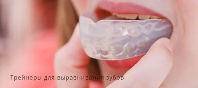 Капа для выравнивания зубов в Минске