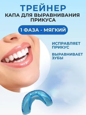 Элайнеры в Киеве ➡️ Ортодонтические капы для выравнивания зубов ✓ Клиника  Доброго Стоматолога