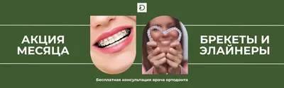 Капы для выравнивания зубов цена в Москве – поставить капы для зубов для  исправления прикуса
