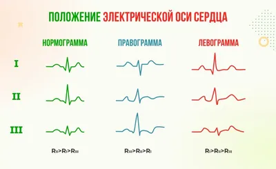 Крупный план электрокардиограммы экг здорового сердца на бумаге | Премиум  Фото