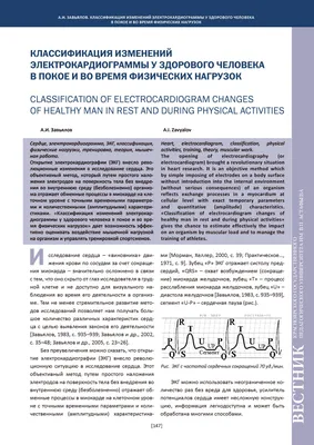 Что значит ЭОС, отклонение влево, вправо, вертикальная, горизонтальная.