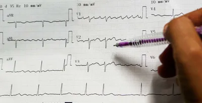 модель человеческого сердца с кардиограммой. концепция кардиогии и  сердечного здоровья Стоковое Изображение - изображение насчитывающей  символ, кардиолог: 232105321