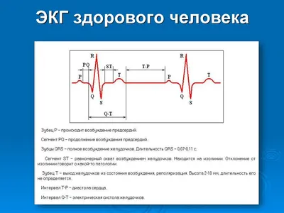 Красное сердце и кардиограмма цвета российского флага на белом фоне ::  Стоковая фотография :: Pixel-Shot Studio