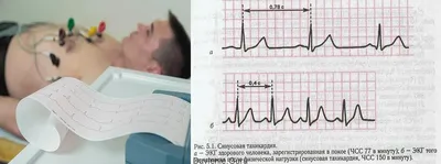 ЭКГ | Сделать экг кардиограмму сердца | Медицинский центр Гастроклиника  Ярославль