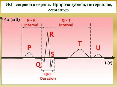 Расшифровать ЭКГ, беспокоюсь Недавно проходил медкомиссию, пришёл на ЭКГ. |  MedAboutMe