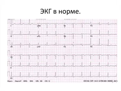 Марка Кипр 1972 здоровье медицина сердце кардиограмма гаш Лот №6538483415 -  купить на Crafta.ua