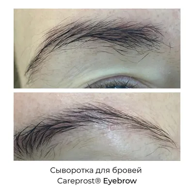 Сыворотки для ресниц и бровей CAREPROST Сыворотка для роста бровей EYEBROW  Капиксил 5% – купить в интернет-магазине ЛЭТУАЛЬ по цене 850 рублей с  доставкой