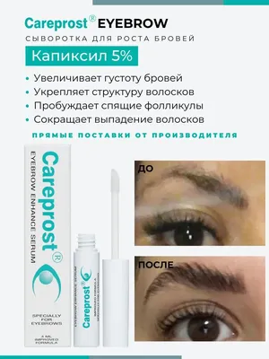 Средство для роста и укрепления ресниц Careprost Bimatoprost Ophthalmic  Solution - «Карепрост, остыв после года использования стимулятора роста  ресниц. Фото до, после, что случилось после отмены.» | отзывы