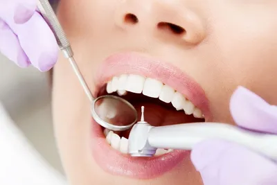 Лечение глубокого кариеса зубов в Москве, цены в стоматологии