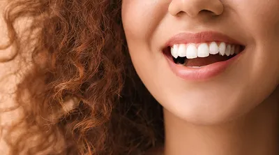 Сколько стоит вылечить кариес зуба - цены в клинике у метро Просвещения