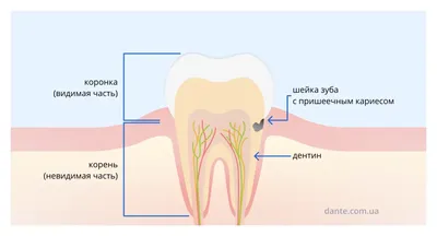 Лечение пришеечного кариеса: цена от 2000 руб за лечение кариозных  поражения передних зубов