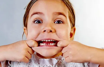 Что такое циркулярный кариес молочных зубов? - энциклопедия Ochkov.net
