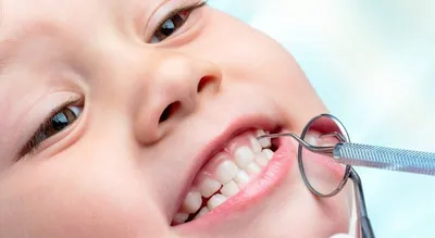 Кариес молочных зубов у детей | TopDent | Дзен