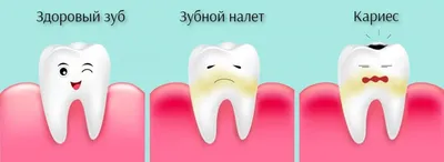 Глубокий кариес зубов – симптомы, лечение в Москве – цены, отзывы в  стоматологических клиниках Зуб.ру