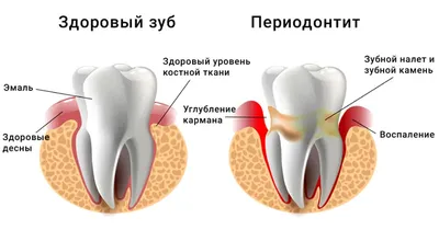 БЕЗ КЮРЕТАЖА | Спасибо.Клиник | Дзен