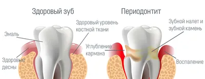 Ультразвуковая чистка зубов цена стоимость в Москве стоматология Внуки  Гиппократа