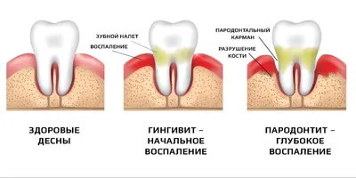 Закрытый кюретаж в Минске: цены, отзывы