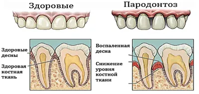 Черные зубы [как лечить и почему зуб внутри черный]