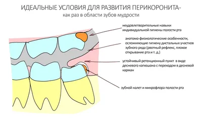 Кюретаж в стоматологии - открытый, закрытый кюретаж зубов и десен