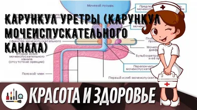 Полип уретры: симптомы, причины, диагностика и лечение у женщин и мужчин в  клинике «АльтраВита»