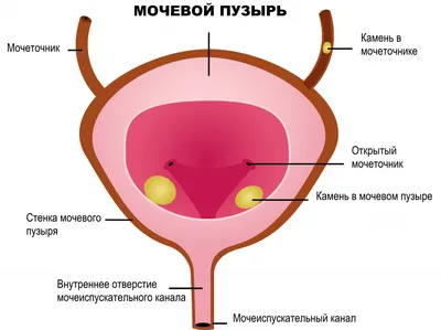 Цистоскопия мочевого пузыря в клиниках Москвы • Русский Доктор