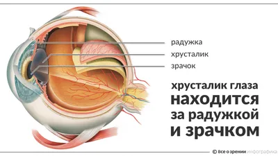 Рис. 2. Глаз пациентки М. спустя 7 лет после операции по удалению ката…