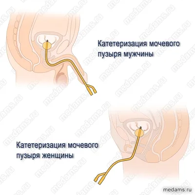 Мочеприемники. Алтаймедснаб — медтехника, расходные материалы для клиник и  медицинских учреждений