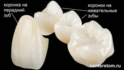 Пример работы керамическая коронка и цельноциркониевая коронка на зуб