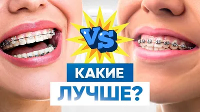 Цена на сапфировые брекеты в Москве | Стоматология «Rudomin»