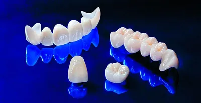 Стоматология DentalHouse - лечение зубов в Бишкеке, все виды  стоматологических услуг