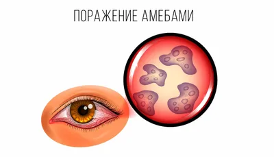 Болезни глаз: виды, причины, симптомы, коррекция | World Vision Clinic