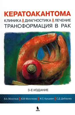 Кератоакантома. Клиника, диагностика, лечение, трансформация и рак, , Бином  купить книгу 5-9518-0150-8 – Лавка Бабуин, Киев, Украина