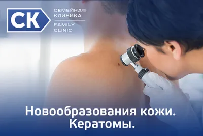 Актинический кератоз — Derma.ua